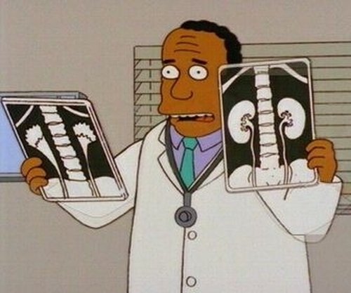 The Simpsons - S10E8: Homer Simpson in: 'Kidney Trouble'