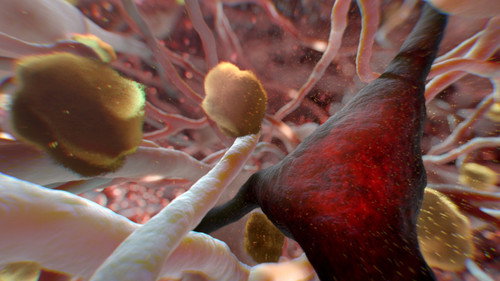 NOVA - S43E19: Can Alzheimer's Be Stopped?