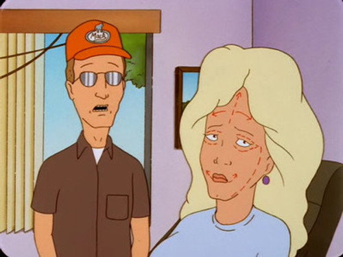 King of the Hill - S5E18: The Trouble with Gribbles