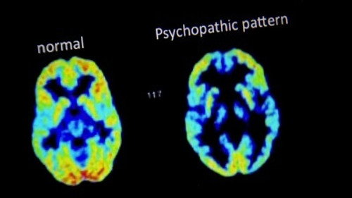 Horizon - S54E12: What Makes a Psychopath?