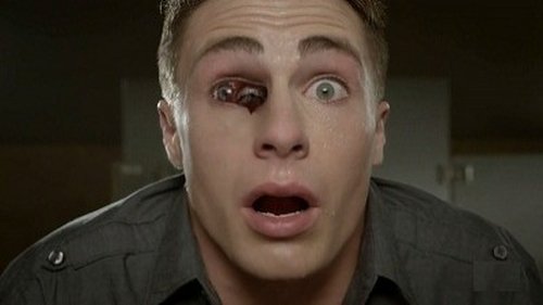 Teen Wolf - S2E7: Restraint
